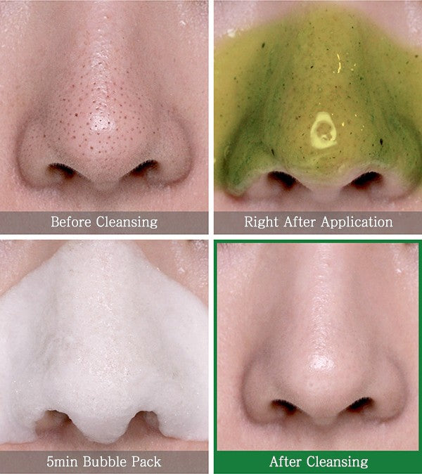 BYE BYE BLACKHEAD 30 DAYS MILACLE GREEN TEA TOX BUBBLE CLEANSER